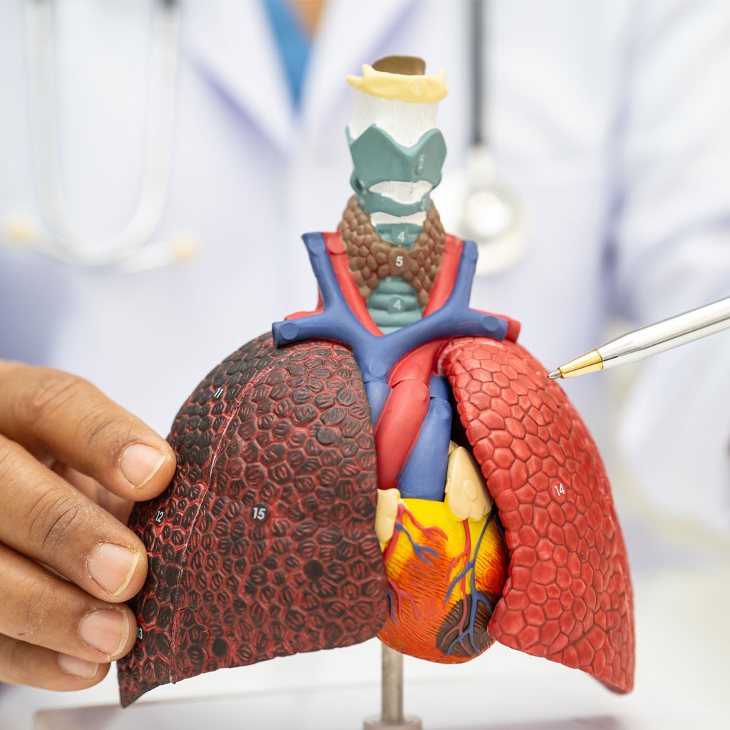 Lungenkrebs Früherkennung