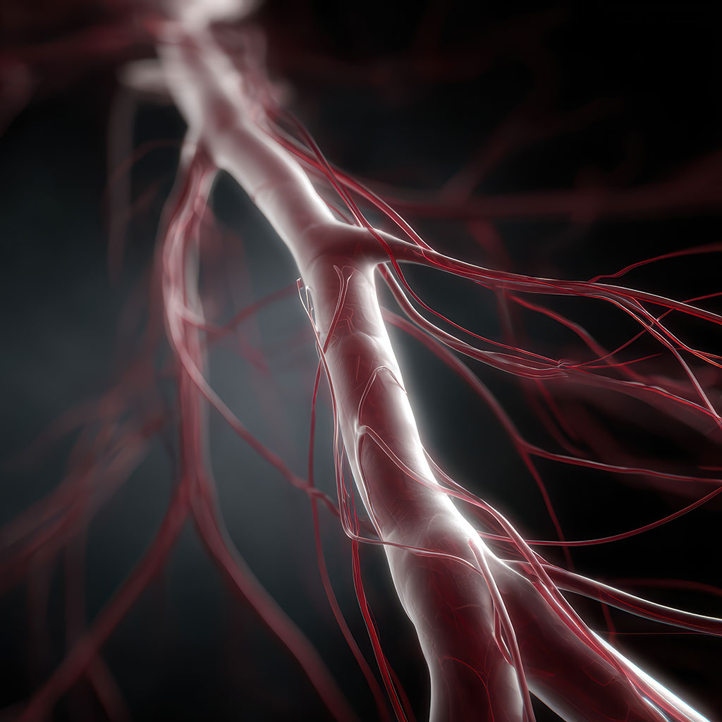 Vorsorge Gefäßerkrankungen