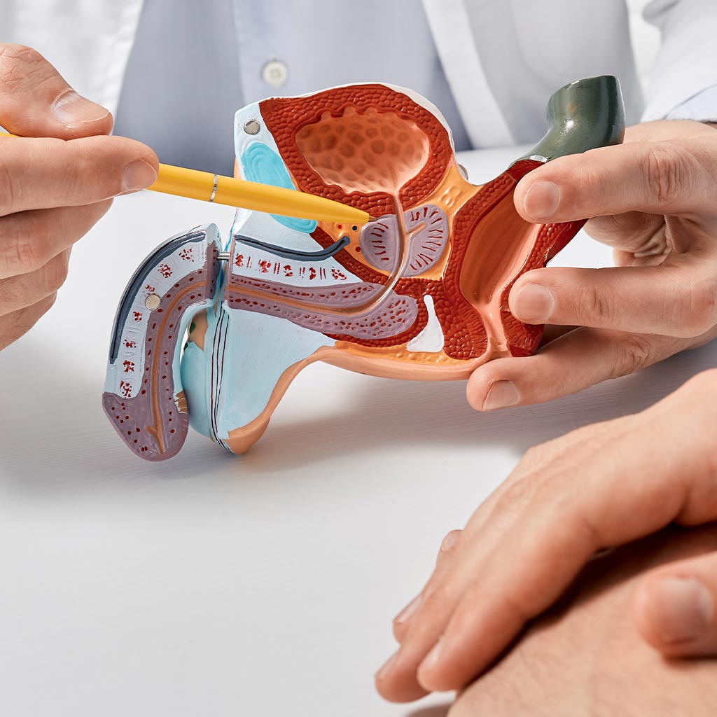 Früherkennung von Prostatakrebs